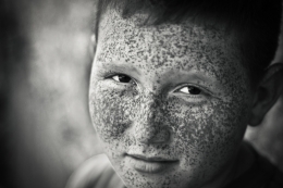 The freckled boy 
