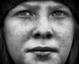 girl with freckles 